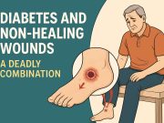Diabetes and Non-Healing Wounds: A Deadly Combination Doctor inspecting a non-healing wound on diabetic foot