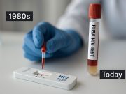 HIV Testing Advances and History Modern and historical HIV testing tools showing progress in diagnostics.