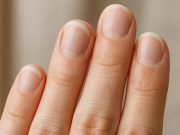 Nail Health and Warning Signs of Chronic Illness Fingernails with abnormalities linked to chronic illness