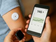Blood Sugar Control Changes and Challenges Digital blood sugar monitoring using CGM and mobile device for diabetes control.