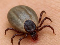 Do We Understand Lyme Disease Causes? Tick on human skin, main cause of Lyme disease
